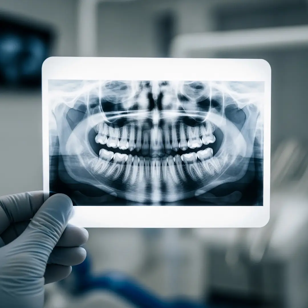 Konzervativní stomatologie